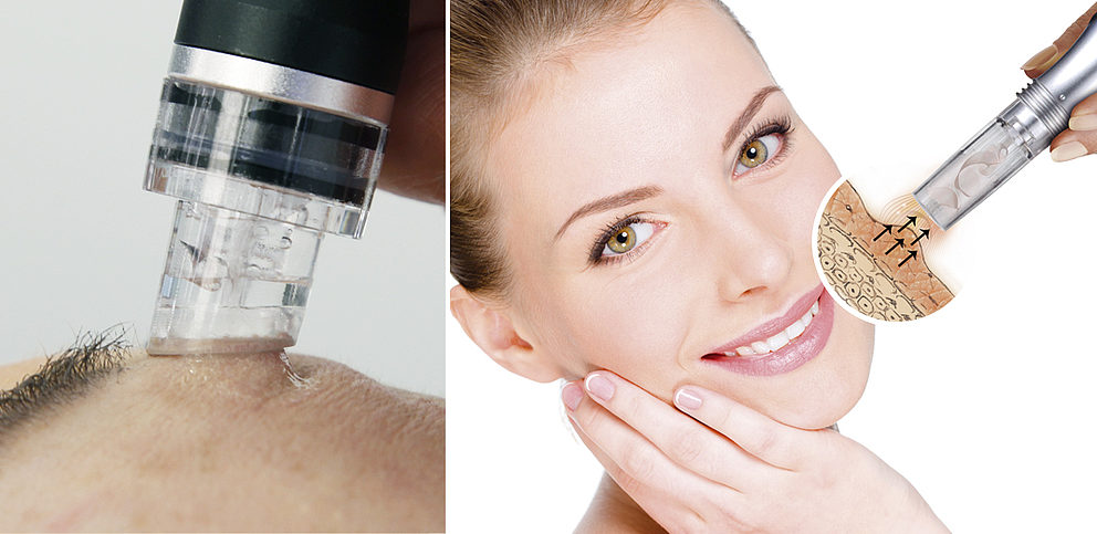 DEYNIQUE Behandlungen – Wirkung in der Haut