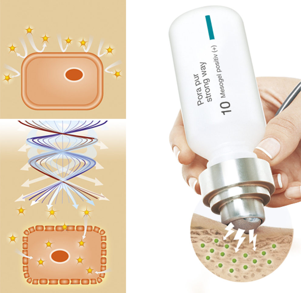 DEYNIQUE PoraPur Behandlung